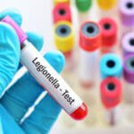 Legionella monitoring, compliance and legislation